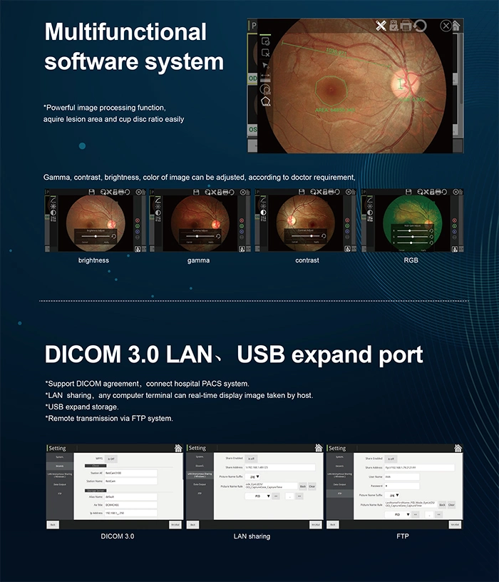 Ret-3100b China Ophthalmic Auto Digital Eye Fundus Retinal Camera with Built-in Computer