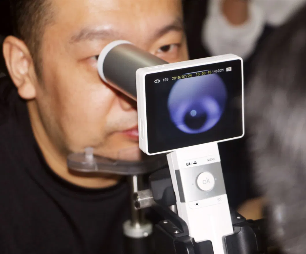 Miis Non Dialated Portable Fundus Camera Made in Taiwan